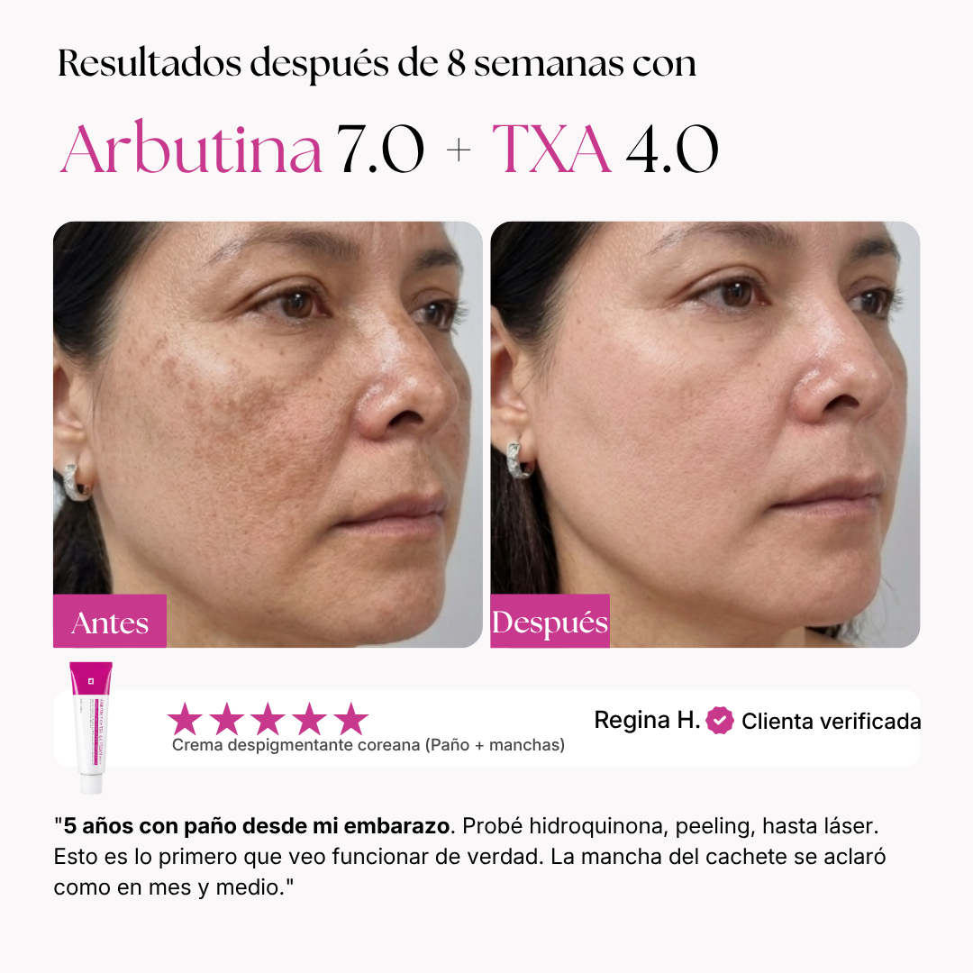 Después